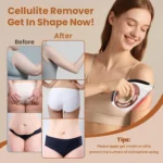 teknobin-media-product-mazoss-selülit-masal-makinesi-rf-teknolojisi_teknobincom_3