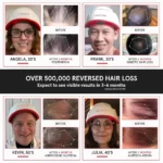 irestore-profesyonel-lazer-kirmizi-isik-terapisi-sac-buyume-sistemi-282-lazer-led-fda-onayli-teknobincom-2